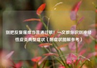 别把反复瘙痒当普通过敏！一文教你识别神经性皮炎典型症状（附症状图解参考）